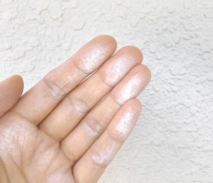 手が白くなった写真